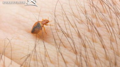 علاج قرصة البق