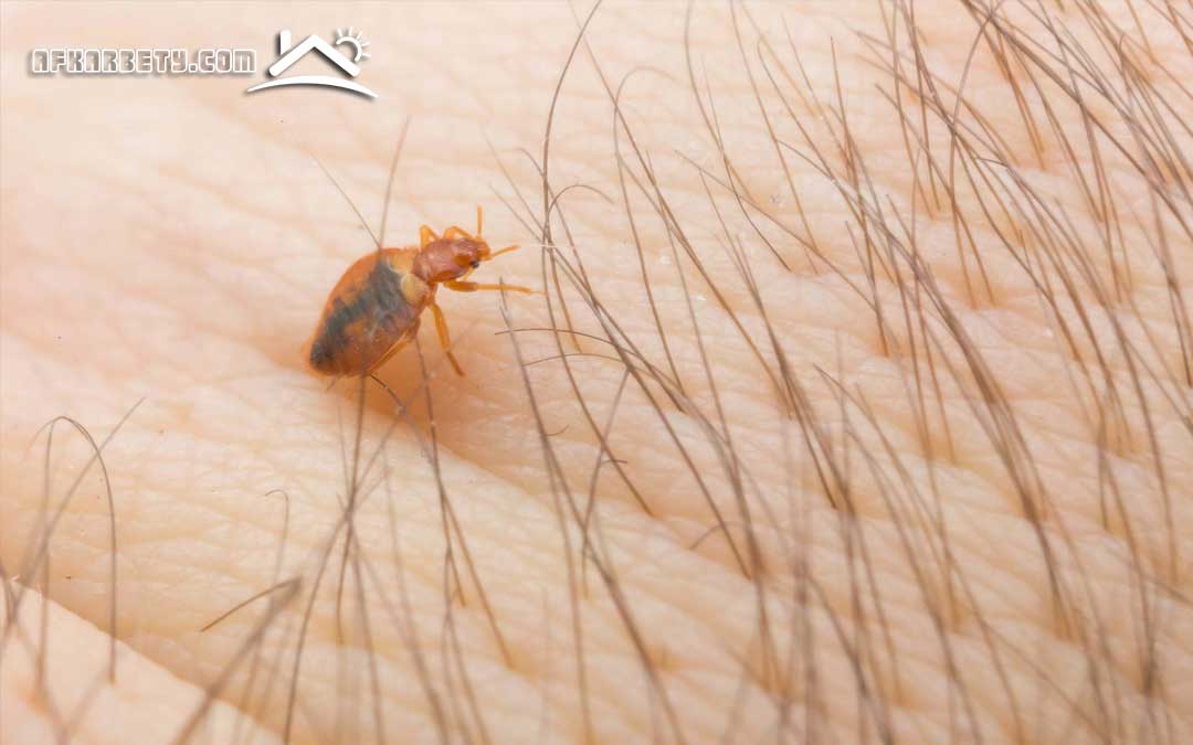 علاج قرصة البق